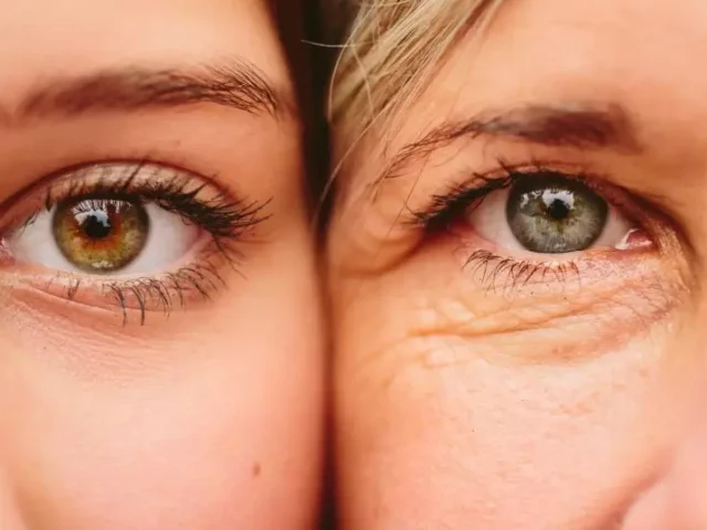 Blefaroplastia antes e depois: A importância de escolher um especialista em Plástica Ocular
