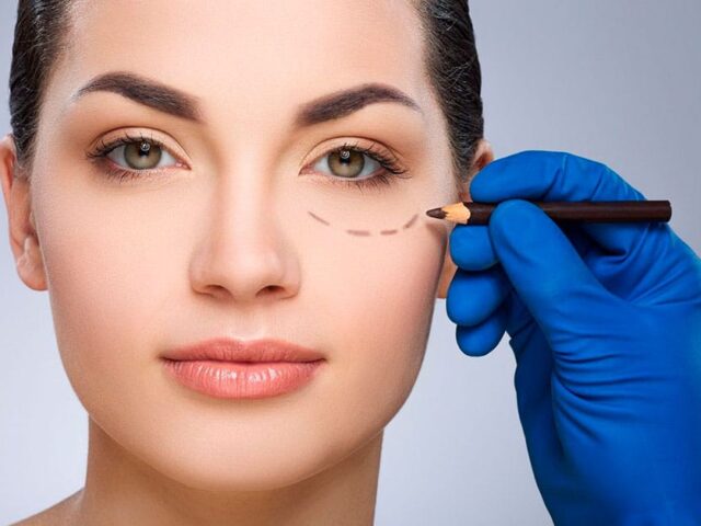 Olhar Cansado? Como a Blefaroplastia pode Rejuvenescer seu Rosto